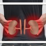 چکاپ منظم؛ راهکار طلایی پیشگیری از بیماری‌های کلیوی